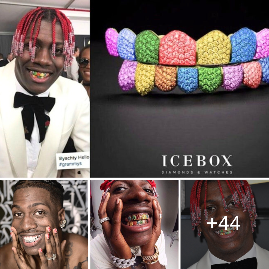 lil yachty grillz